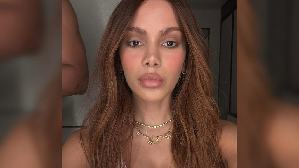 Todos os procedimentos estéticos que Anitta já fez — até agora