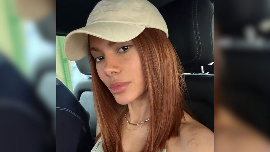 Todos os procedimentos estéticos que Anitta já fez — até agora